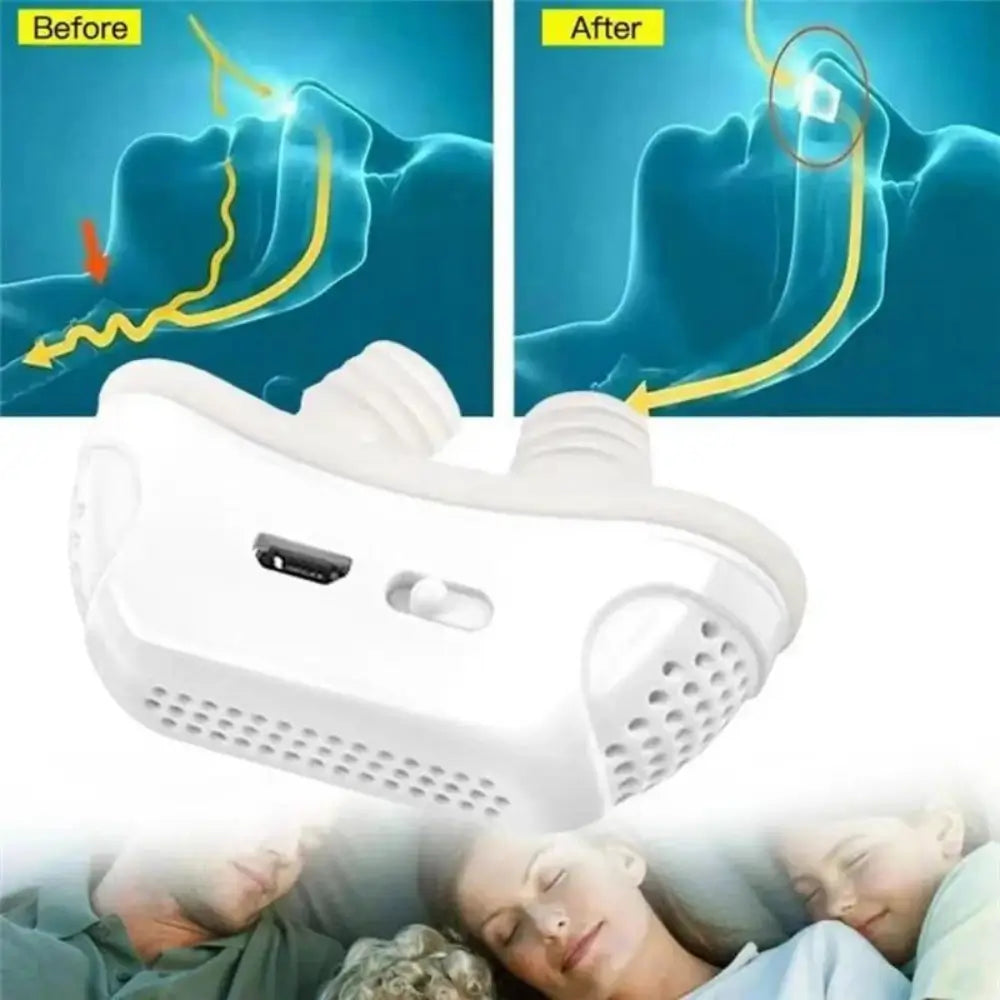 Dilatadores Nasales Antirronquidos con Filtro de Aire: Confort y Eficiencia Respiratoria